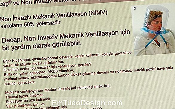 Mekanik ventilasyon için difüzörler